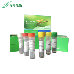 禽副粘病毒1型染料法熒光定量RT-PCR試劑盒