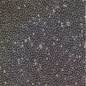 氣管上皮細(xì)胞