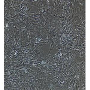腎小球內(nèi)皮細(xì)胞