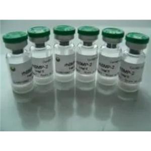 果糖二磷酸醛縮酶B(ALDOB)重組蛋白 生產供應商 艾普蒂生物