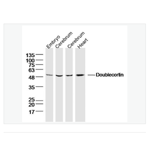 Anti-Doublecortin antibody-雙皮質(zhì)素抗體