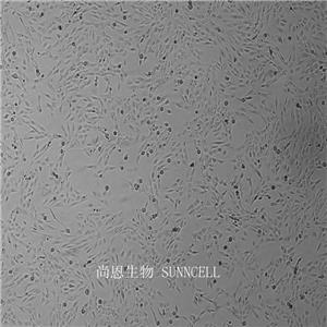 人正常前列腺基質(zhì)永生化細(xì)胞