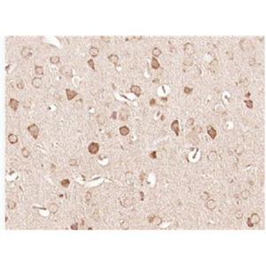 Anti-BNIP3L antibody-促凋亡BNIP3L蛋白抗體